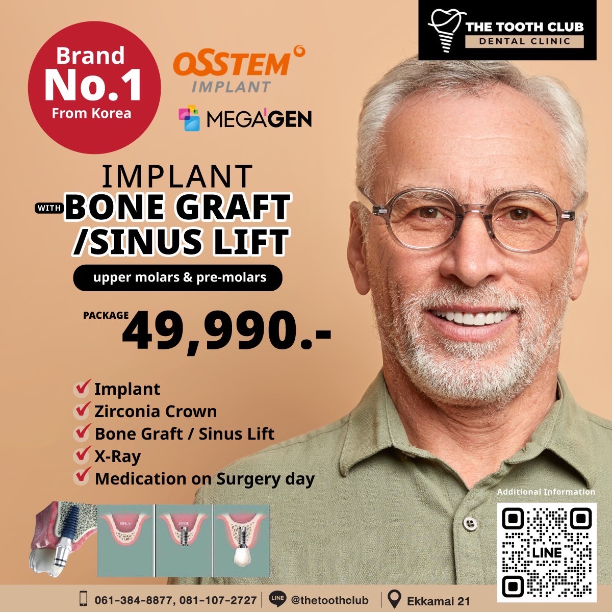 Includes all sizes of Sinus Lift - 49,990 net.