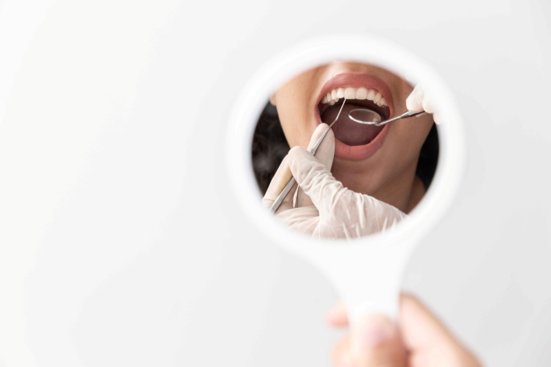 How many dental implants are necessary if one needs implants for the entire mouth ?