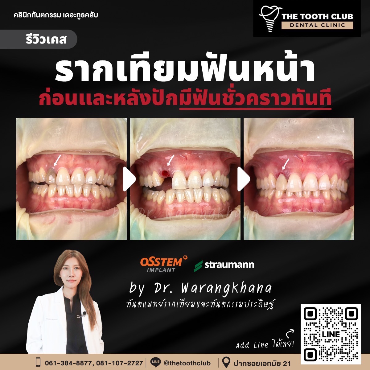รูปที่ 4