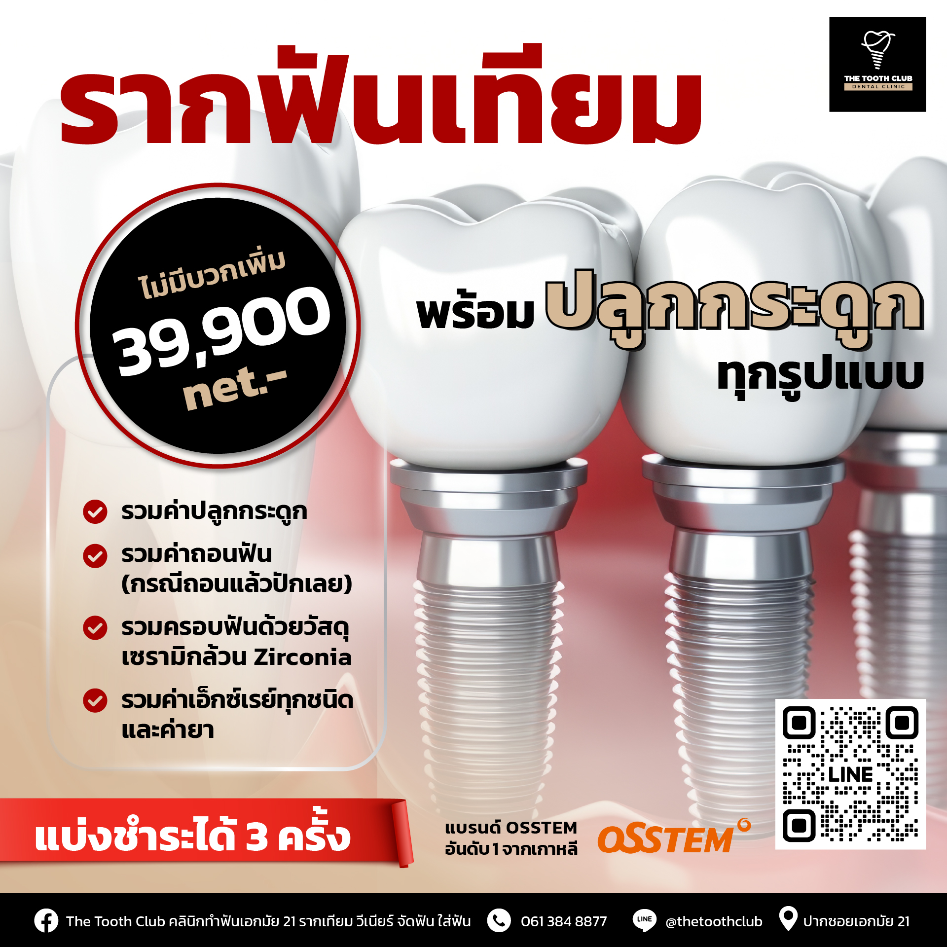 โปร!! รากเทียมรวมปลูกกระดูก 39,990.-