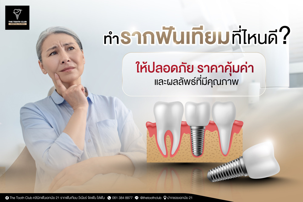 ทำรากฟันเทียมที่ไหน ? ให้ปลอดภัย ราคาคุ้มค่า และผลลัพธ์ที่มีคุณภาพ