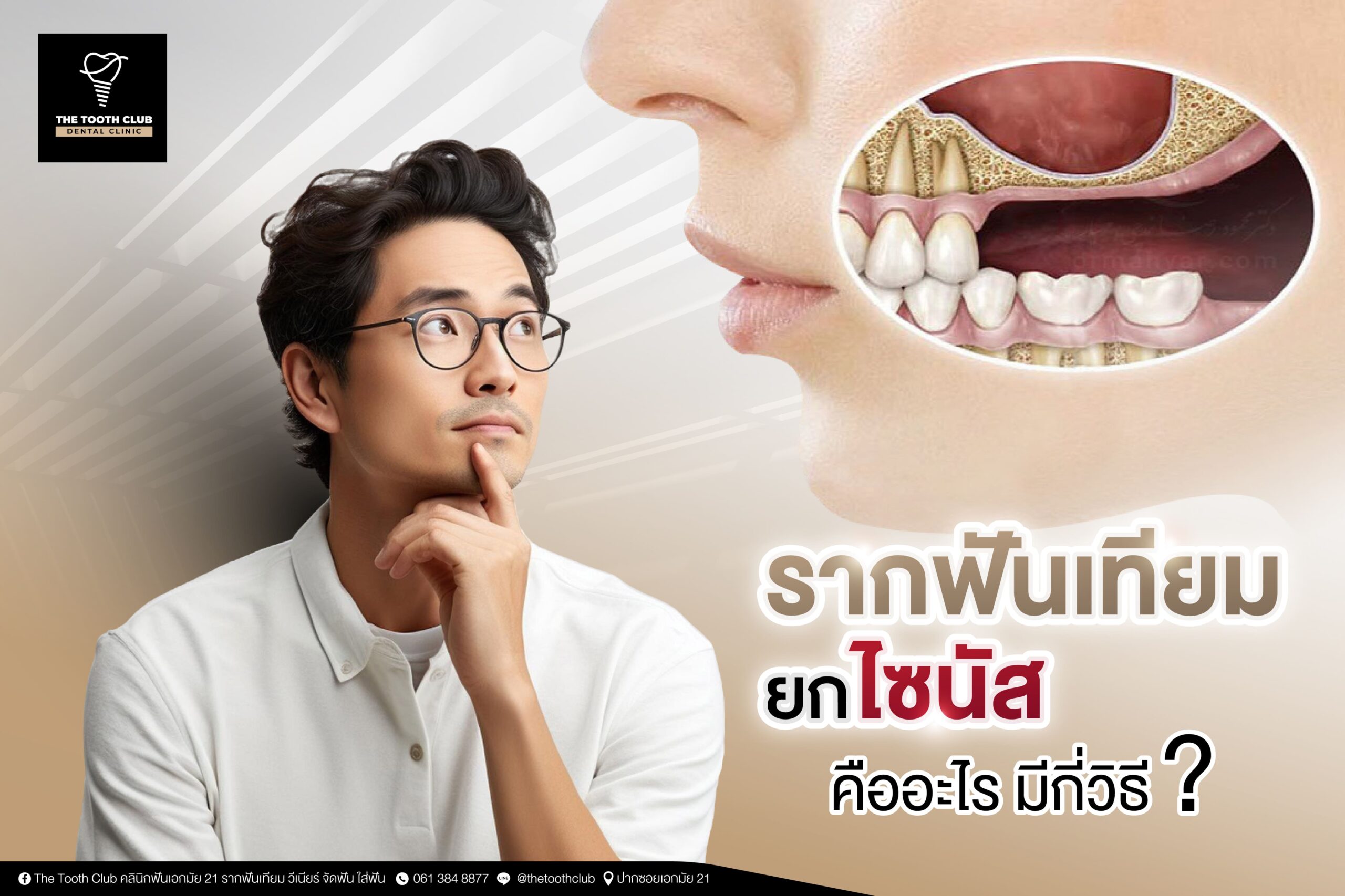 รากฟันเทียม ยกไซนัส คืออะไร มีกี่วิธี ?